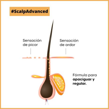 Scalp Advanced Champú Anti Malestar